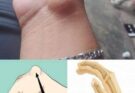 ⚠️BE CAREFUL, If you spot these dots on your skin, it means you have Ca…see more